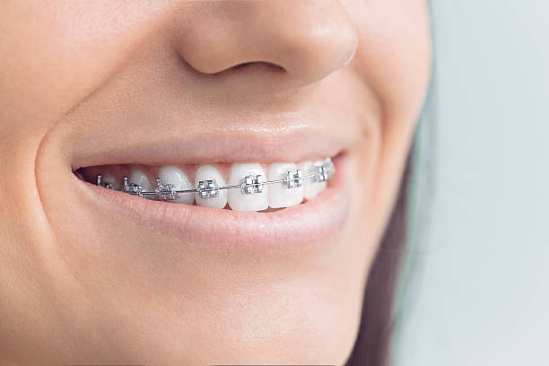 Best Invisalign and Clear Aligners  in Tyler Run, PA